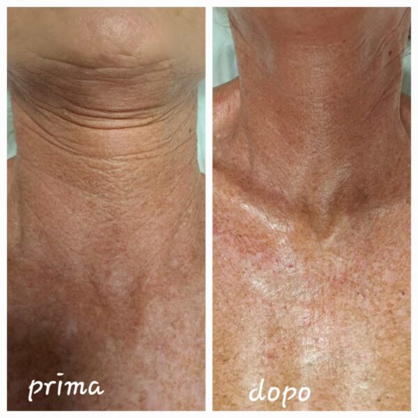 Tesla med prima e dopo